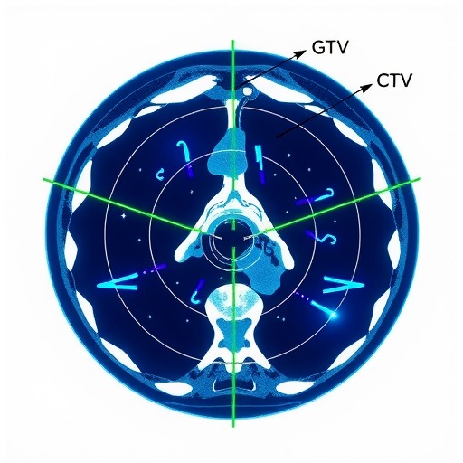 柏视医疗黄海滨:同时勾画GTV和CTV的放疗AI产品才具临床应用价值(图1) 柏视医疗黄海滨:同时勾画GTV和CTV的放疗AI产品才具临床应用价值(图1)