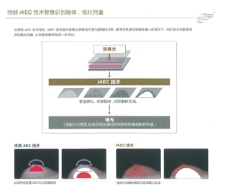 科技实现智慧医疗，富士胶片全新乳腺DR“星奕 炫”璀璨问世(图6)