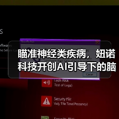 瞄准神经类疾病,妞诺科技开创AI引导下的脑电行业新模式(图3) 瞄准神经类疾病,妞诺科技开创AI引导下的脑电行业新模式(图3)