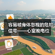 容易被身体忽视的危险信号——心室晚电位（图1）
