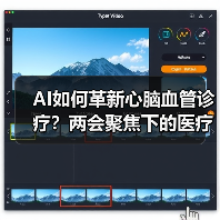 AI如何革新心脑血管诊疗?两会聚焦下的医疗新突破(图4) AI如何革新心脑血管诊疗?两会聚焦下的医疗新突破(图4)